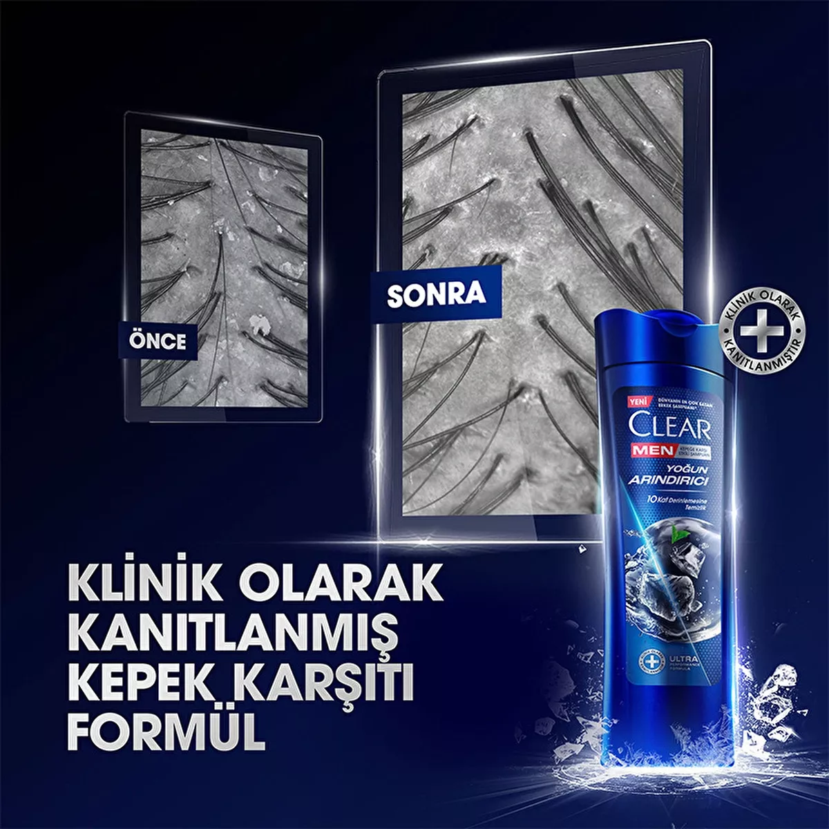 Clear Men kömürli goňak garşy şampun 350 ml - 25072006 — surat 4/11
