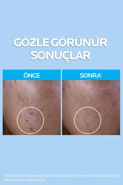 La Roche-Posay Effaclar Ýagly deri üçin arassalaýjy gel, 400 ml - 17598744 — surat 4/7